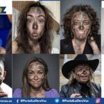 EMERGENCIA EN PABELLÓN DE QUEMADOS POR COMICIOS LEGISLATIVOS